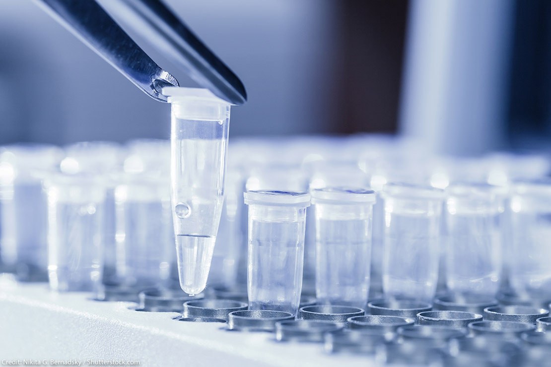 Close-up of tweezers loading test tubes with sampled DNA.